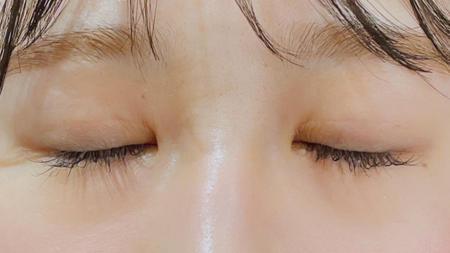 Postoperative Condition Part 1