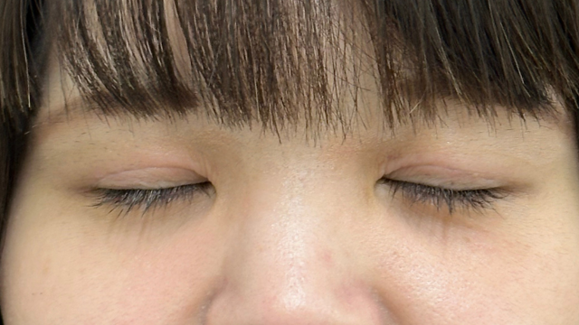 Postoperative Condition Part 1