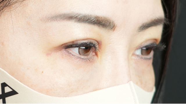 Postoperative Condition Part 1