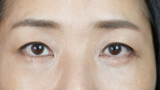 Postoperative Condition Part 1