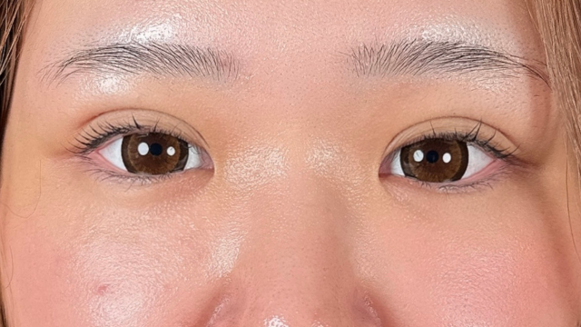 Postoperative Condition Part 1