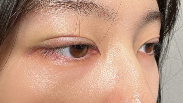 Postoperative Condition Part 1