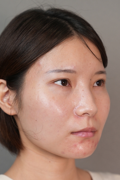 Postoperative Condition Part 1