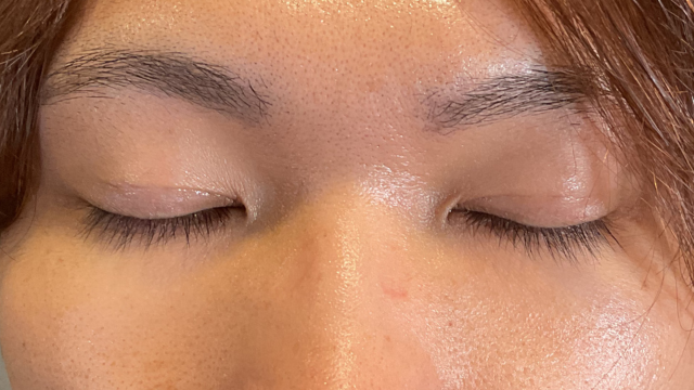 Postoperative Condition Part 1