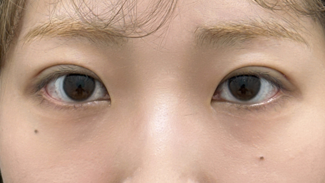 Postoperative Condition Part 1