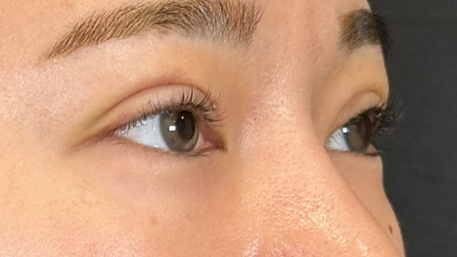 Postoperative Condition Part 1