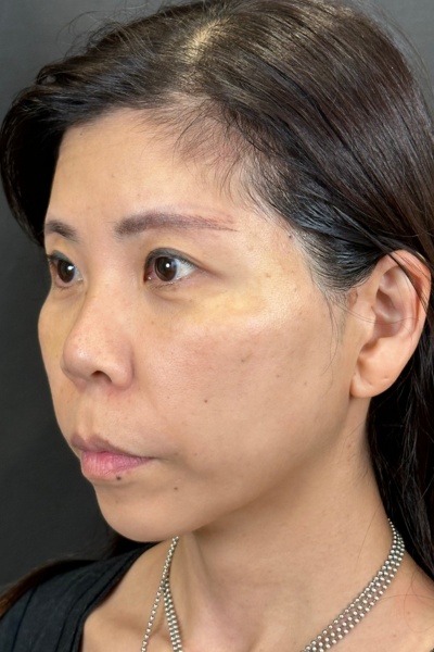 Postoperative Condition Part 1