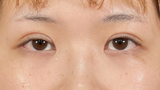 Postoperative Condition Part 1