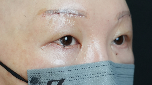 Postoperative Condition Part 1