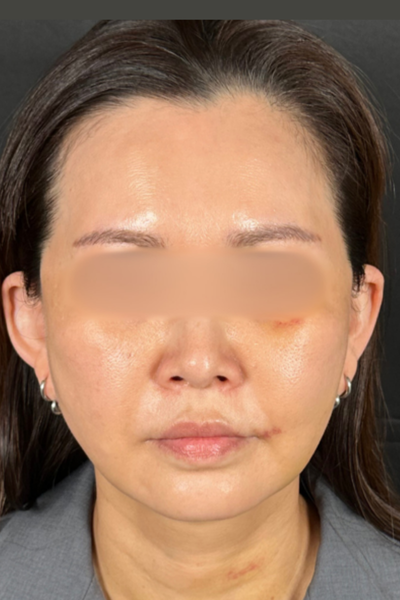 Postoperative Condition Part 1