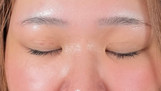 Postoperative Condition Part 1