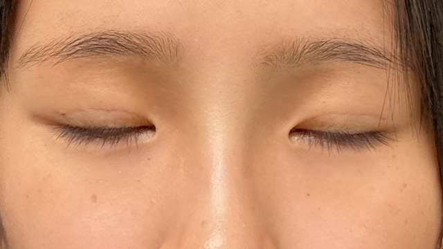 Postoperative Condition Part 1