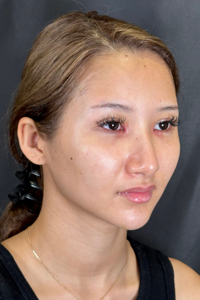 Postoperative Condition Part 1