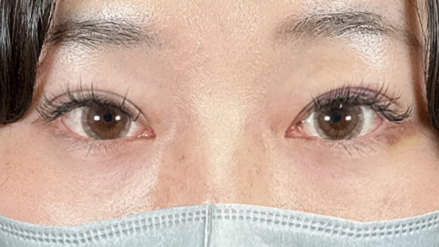 Postoperative Condition Part 1