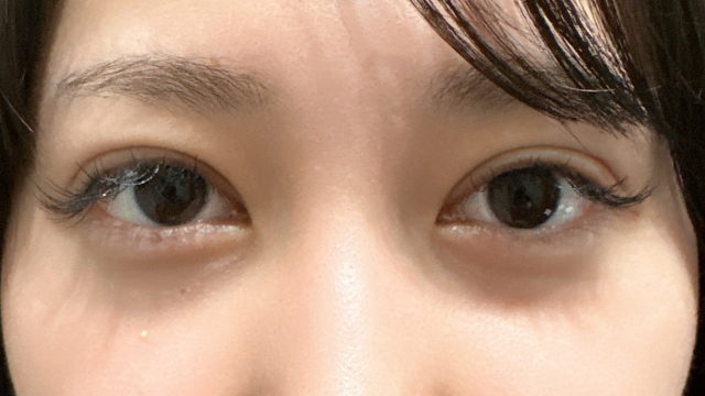 Postoperative Condition Part 1