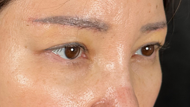 Postoperative Condition Part 1