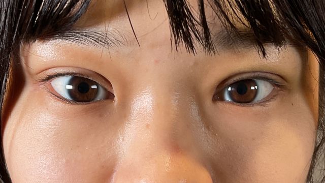 Postoperative Condition Part 1