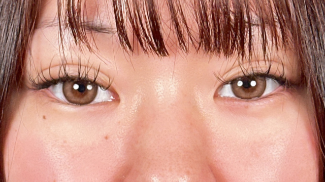 Postoperative Condition Part 1