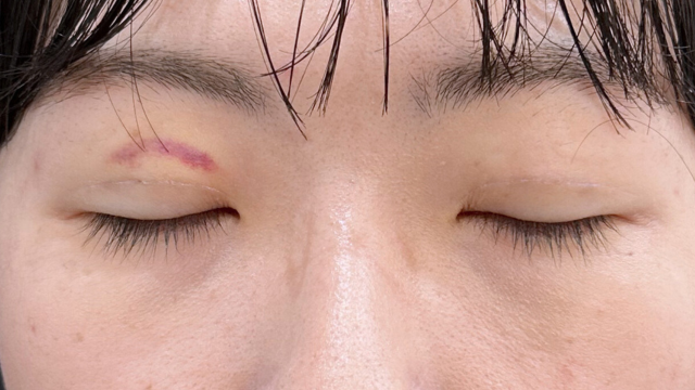 Postoperative Condition Part 1