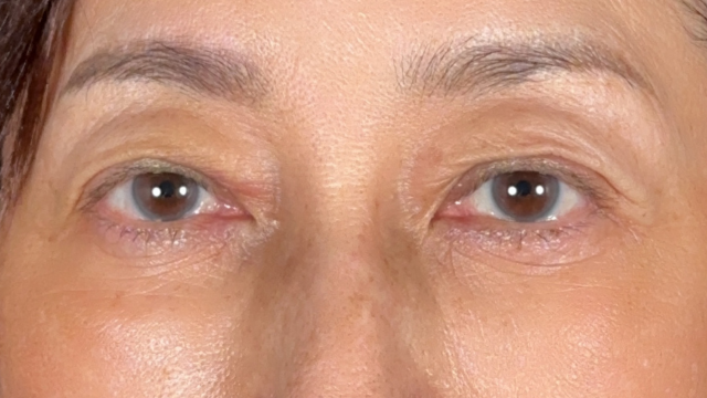 Postoperative Condition Part 1