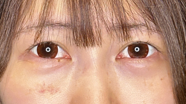 Postoperative Condition Part 1