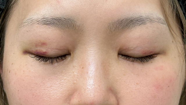 Postoperative Condition Part 1