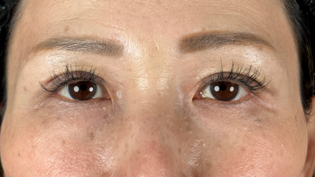 Postoperative Condition Part 1