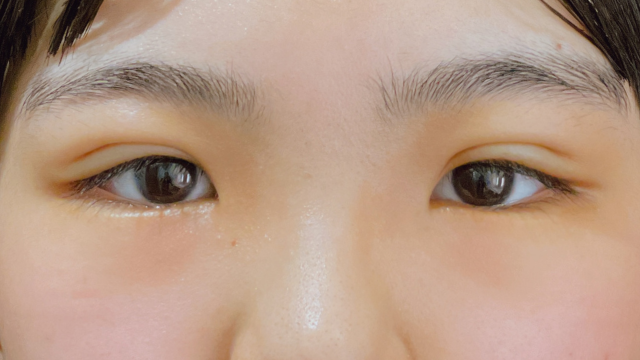 Postoperative Condition Part 1