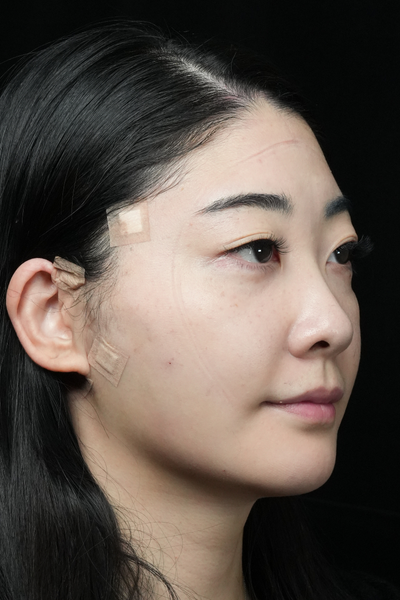 手術前の状態 その1