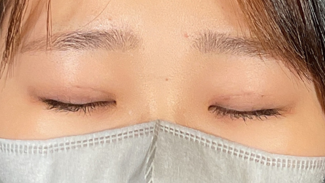 Postoperative Condition Part 1