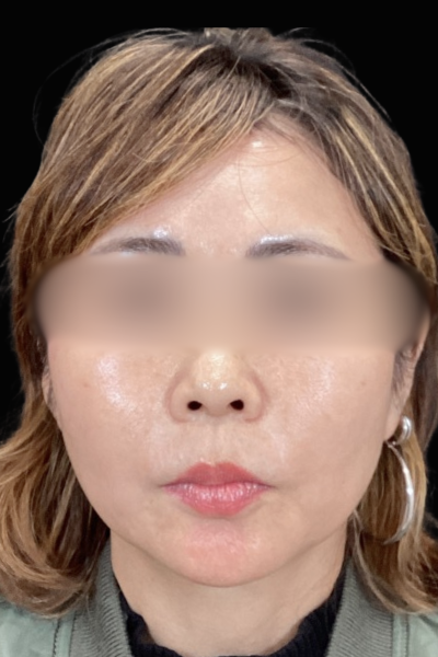 Postoperative Condition Part 1