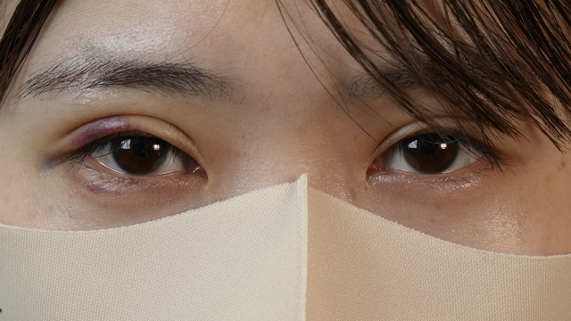 Postoperative Condition Part 1