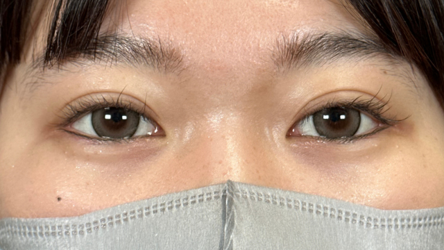 Postoperative Condition Part 1