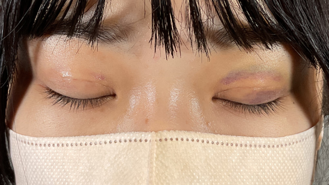 Postoperative Condition Part 1