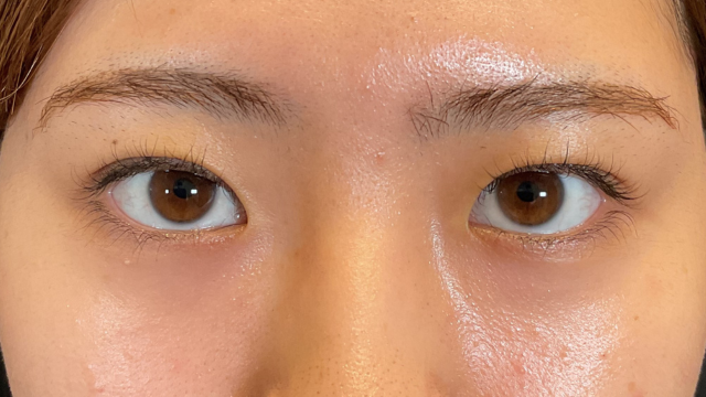 Postoperative Condition Part 1