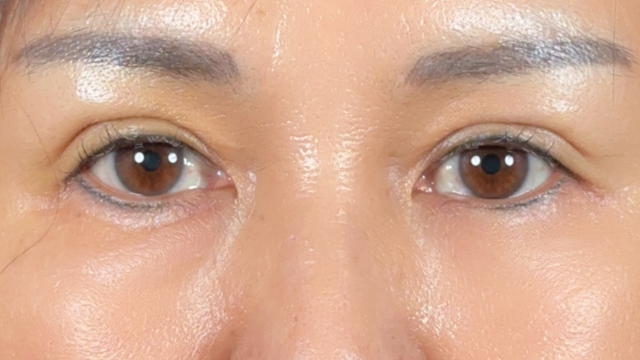 Postoperative Condition Part 1