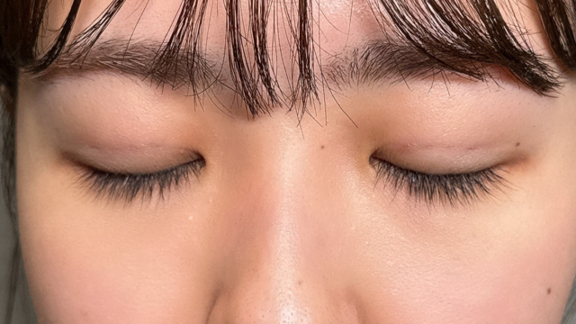 Postoperative Condition Part 1