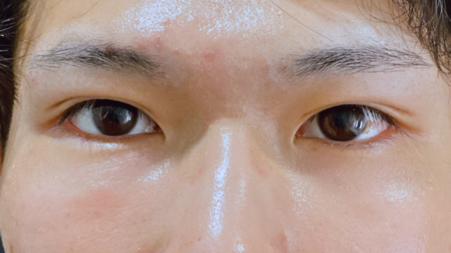 Postoperative Condition Part 1