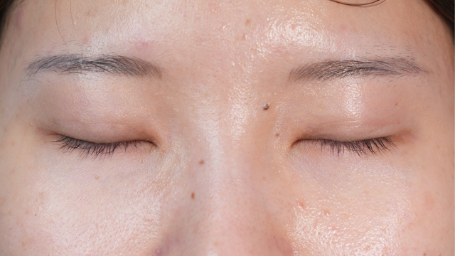 Postoperative Condition Part 1