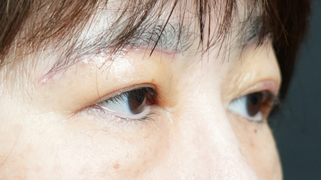 Postoperative Condition Part 1