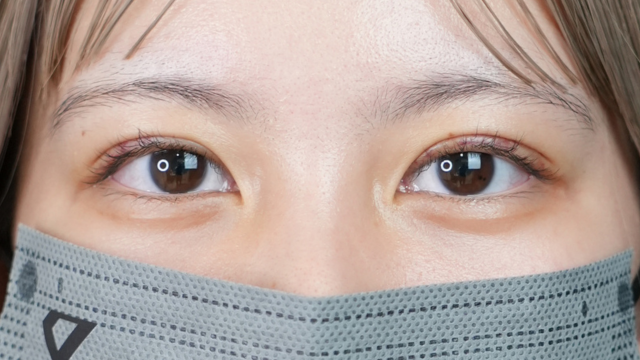 Postoperative Condition Part 1