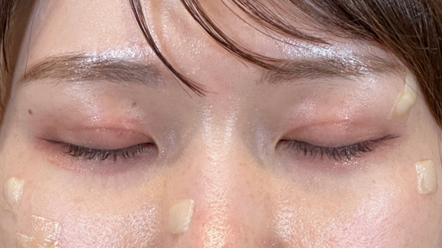 Postoperative Condition Part 1