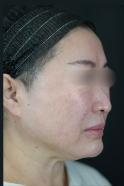 手術前の状態 その1