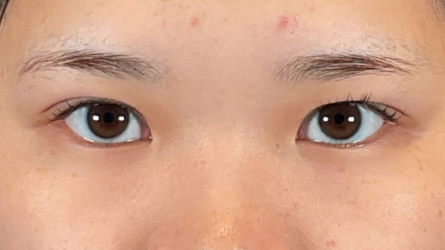 Postoperative Condition Part 1