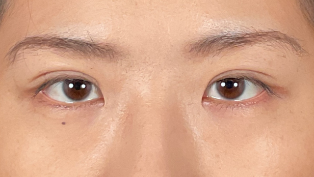 Postoperative Condition Part 1