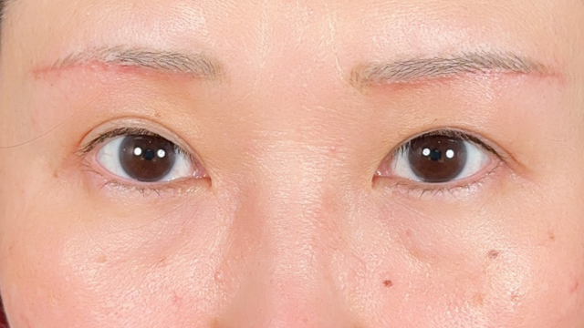 Postoperative Condition Part 1