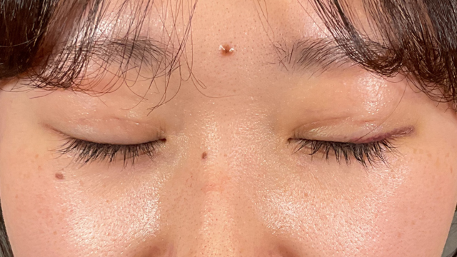 Postoperative Condition Part 1