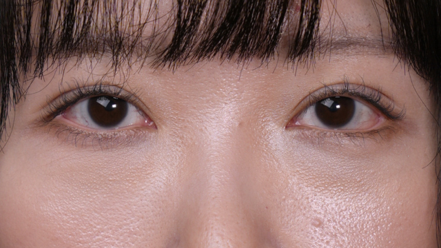 Postoperative Condition Part 1