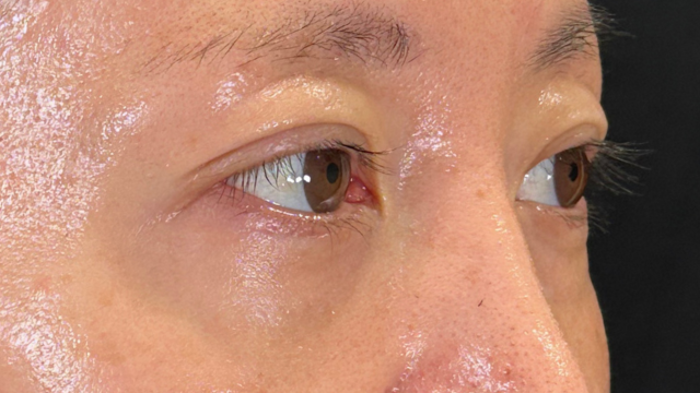 Postoperative Condition Part 1