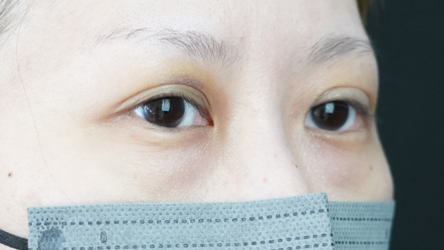 Postoperative Condition Part 1